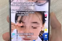 Vụ "dọa" lấy ven cho bệnh nhân trật 3 lần: Trường Đại học Y Hà Nội xử lý kỷ luật 2 sinh viên 