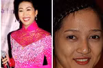  Khi mỹ nhân "thảm hại" vì ... răng