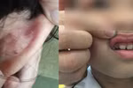 Học sinh Tiểu học Tân Triều tố bị giáo viên đánh sẽ chuyển trường 