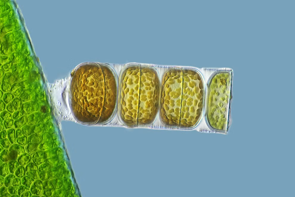 Một mẫu vật sống của loài Melosira moniliformis được phóng đại lên 320 lần qua bức ảnh của Frank Fox, đến từ trường Đại học thực hành Fachhochschule Trier, thuộc Trier, Rheinland-Pfalz, Đức. Một mẫu vật sống của loài Melosira moniliformis được phóng đại lên 320 lần qua bức ảnh của Frank Fox, đến từ trường Đại học thực hành Fachhochschule Trier, thuộc Trier, Rheinland-Pfalz, Đức.