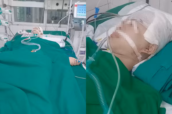 Hình ảnh cháu B. vẫn trong trạng thái hôn mê. Về phía gia đình của những học sinh có liên quan hành hung cháu B. cũng đã đến bệnh viện thăm hỏi cháu.(Ảnh: gia đình cung cấp)