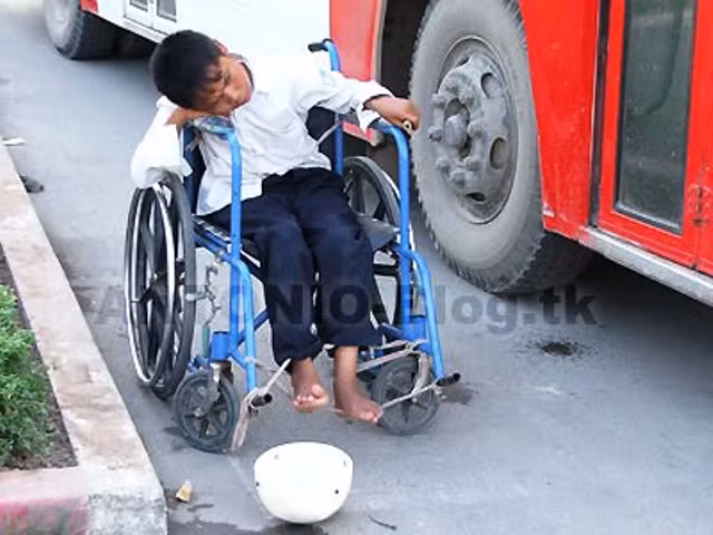 Cậu bé tàn tận gục đầu cam chịu trên xe lăn, trước mặt là cái nắp nhựa để xin tiền (Ảnh Bạn đọc) Cậu bé tàn tận gục đầu cam chịu trên xe lăn, trước mặt là cái nắp nhựa để xin tiền (Ảnh Bạn đọc)