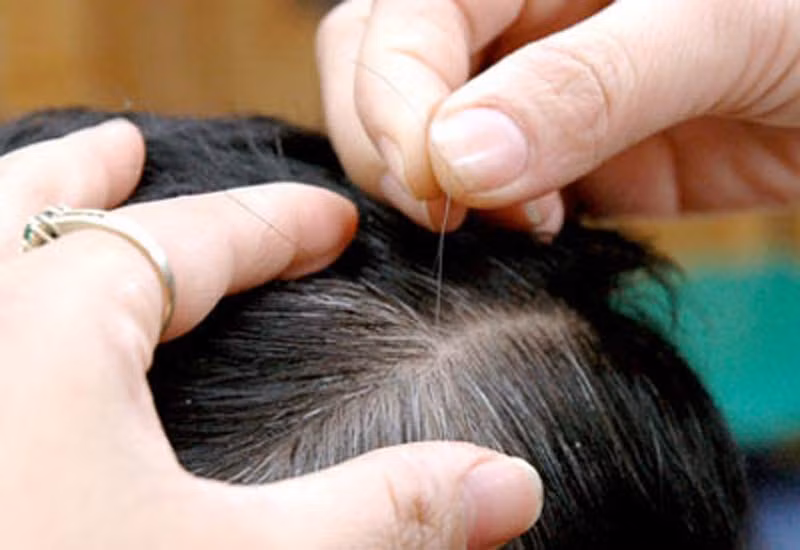 10. Nhổ tóc bạc Thay vì phải nhờ vợ, "thuê’’ con cháu nhổ tóc bạc, tóc sâu, nhiều người cả tây lẫn ta tìm đến các quán nhổ tóc bạc. Dù đông nghịt khách, nhiều người kiên nhẫn chờ đợi từ rất lâu. 10. Nhổ tóc bạc Thay vì phải nhờ vợ, "thuê’’ con cháu nhổ tóc bạc, tóc sâu, nhiều người cả tây lẫn ta tìm đến các quán nhổ tóc bạc. Dù đông nghịt khách, nhiều người kiên nhẫn chờ đợi từ rất lâu.