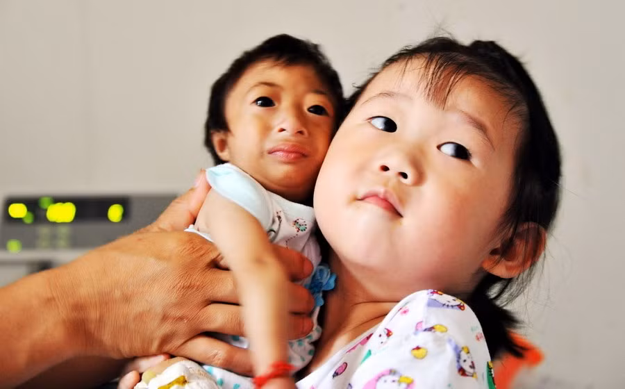 So với bạn bè cùng trang lứa, em bé này có khuôn mặt già dặn hơn nhưng lại bé nhỏ hơn rất nhiều