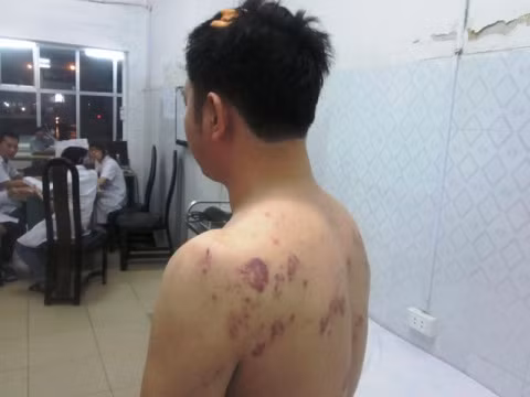 Sau cuộc "tra tấn", anh Bảo bị nhiều thương tích và phải cấp cứu ở BV. Ảnh minh họa