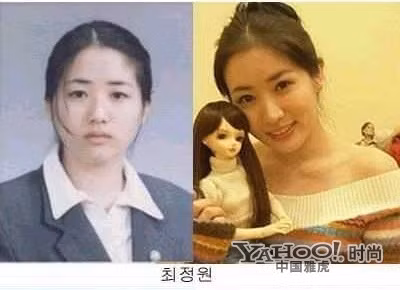 Choi Jung Won, cô em ba xinh đẹp của "những nàng công chúa nổi tiếng" đã cuốn hút bao người bởi vẻ ngoài xinh xắn, nhưng đó lại là sản phẩm của thẩm mỹ hiện đại. Ảnh: Yahoo