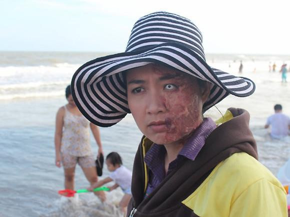 Con mắt bên trái toàn lòng trắng cùng một nửa khuôn mặt bị biến dạng do bị tạt axit của diễn viên Lê Khánh thực sự khiến người xem sợ hãi Con mắt bên trái toàn lòng trắng cùng một nửa khuôn mặt bị biến dạng do bị tạt axit của diễn viên Lê Khánh thực sự khiến người xem sợ hãi