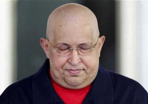 Tổng thống Venezuela Hugo Chavez đang điều trị ung thư