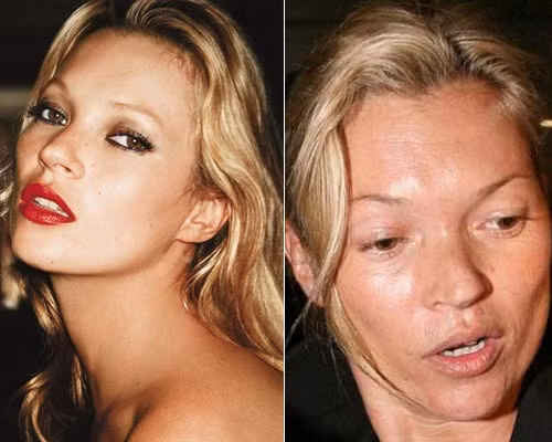 Kate Moss 38 tuổi nhưng trông gương mặt cô đầy nếp nhăn, mụn như bà già. Kate Moss 38 tuổi nhưng trông gương mặt cô đầy nếp nhăn, mụn như bà già.