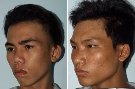 Đối tượng Nguyên và Nghĩa