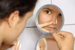 6 cách hay giảm nhanh mụn nội tiết tố