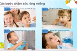 Chăm sóc răng miệng không đúng cách hậu quả khó lường