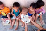 Thực trạng suy dinh dưỡng trẻ em dưới 5 tuổi hiện nay
