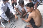 Nát bàn tay, người chi chít vết thương vì cưa hộ thỏi sắt