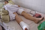 Sập phòng dạy thêm, 2 học sinh bị thương