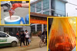 Sốc: Nhau thai người được bán như...thịt lợn (Hà Nội)