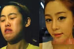 Công nghệ thẩm mỹ biến "vịt" thành "hot girl" ở xứ Kim chi