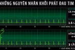 Ăn quá no làm tăng nguy cơ đau tim gấp 7 lần