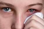 Ngắm mắt có thể đoán ra bệnh: ung thư, gan, đột qụy,..? 