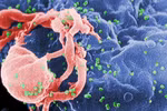  Cẩn thận với “thần dược” chữa HIV 