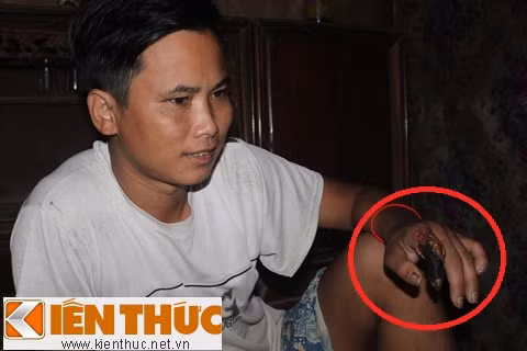 Suýt bỏ mạng vì "rắn thần", Tin tức trong ngày, ran than, ran ho chua, ho mang chua, ran ho mang, ruou ran, ngam ruou ran, ngam ruou, ruou thuoc, ruou bo, thap toan dai bo, ruou bo duong, bao, tin hay, tin hot, tin tuc, vn