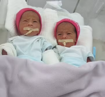 Hai em bé này đều có cân nặng 1,3kg và yếu hơn các bé khác. Ảnh TN