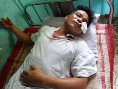 Đang ăn cơm tối, cả gia đình bị côn đồ rượt chém kinh hoàng ảnh 2 Đang ăn cơm tối, cả gia đình bị côn đồ rượt chém kinh hoàng ảnh 2