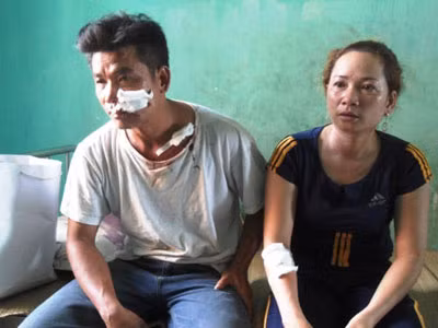 Đang ăn cơm tối, cả gia đình bị côn đồ rượt chém kinh hoàng ảnh 1 Đang ăn cơm tối, cả gia đình bị côn đồ rượt chém kinh hoàng ảnh 1