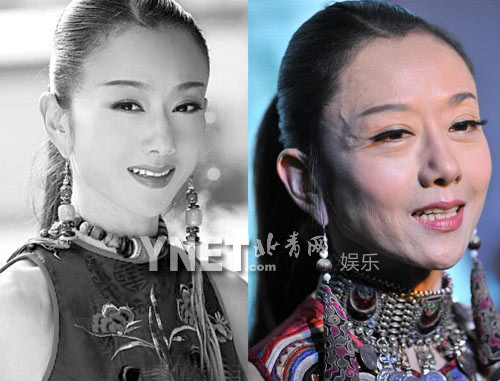 Dương Lệ Bình da mặt vừa nhăn vừa bị nổi gân
