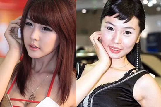 Những hình ảnh trước vào sau cuộc trùng tu nhan sắc của Lee Ji Woo: Những hình ảnh trước vào sau cuộc trùng tu nhan sắc của Lee Ji Woo: