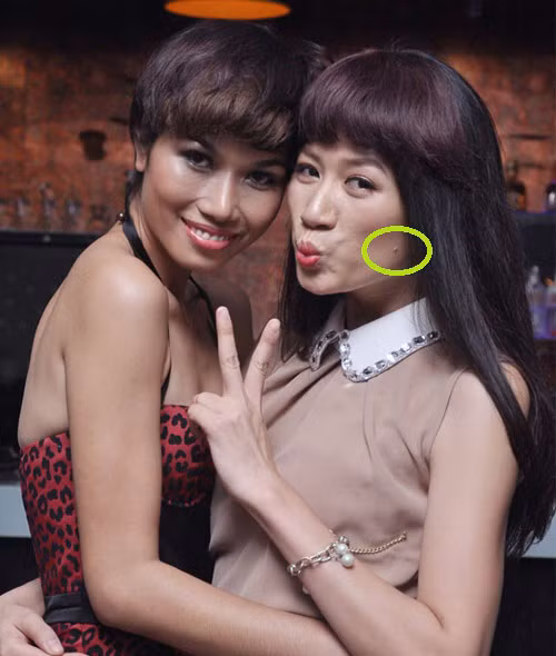 ... thì những vết mụn đáng ghét đó cũng chẳng buông tha cô. ... thì những vết mụn đáng ghét đó cũng chẳng buông tha cô.
