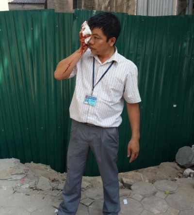 Người nhà của chủ đầu tư cản trở cơ quan chức năng bằng "gạch". Ảnh: tư liệu