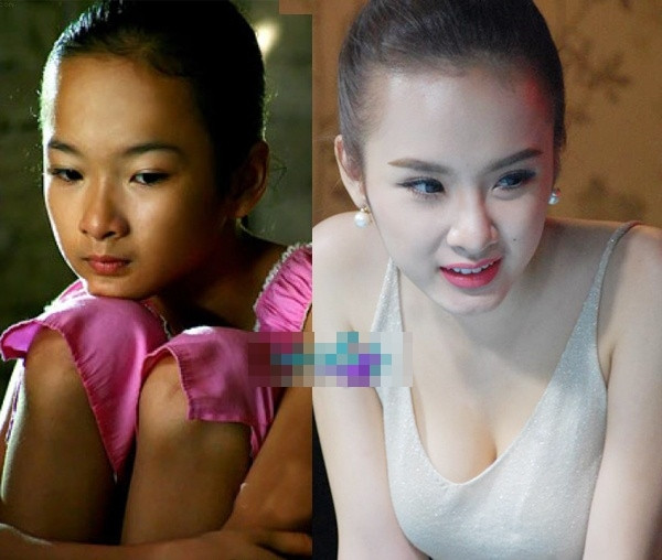 Một cô bé đáng yêu, làn da ngăm đã được thay thế hoàn toàn.