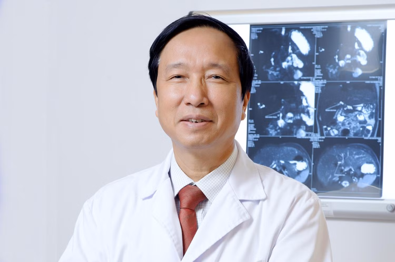 Giáo sư, Tiến sĩ Nguyễn Thanh Liêm - Viện trưởng Viện nghiên cứu Tế bào gốc - công nghệ Gen Vinmec. Ảnh: VOV. Giáo sư, Tiến sĩ Nguyễn Thanh Liêm - Viện trưởng Viện nghiên cứu Tế bào gốc - công nghệ Gen Vinmec. Ảnh: VOV.