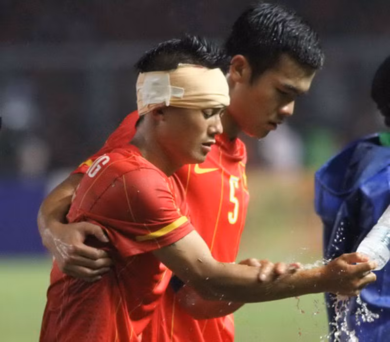 Vệt sáng duy nhất trong đường hầm mà U23 Việt Nam đã đi qua, đó là chiếc băng đầu của Thành Lương Vệt sáng duy nhất trong đường hầm mà U23 Việt Nam đã đi qua, đó là chiếc băng đầu của Thành Lương