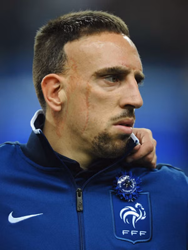 Tiền vệ phải: Franck Ribery - một trong những nhân chứng của cuộc điều tra mà cảnh sát Pháp thực hiện với đường dây cung cấp gái mại dâm vị thành niên