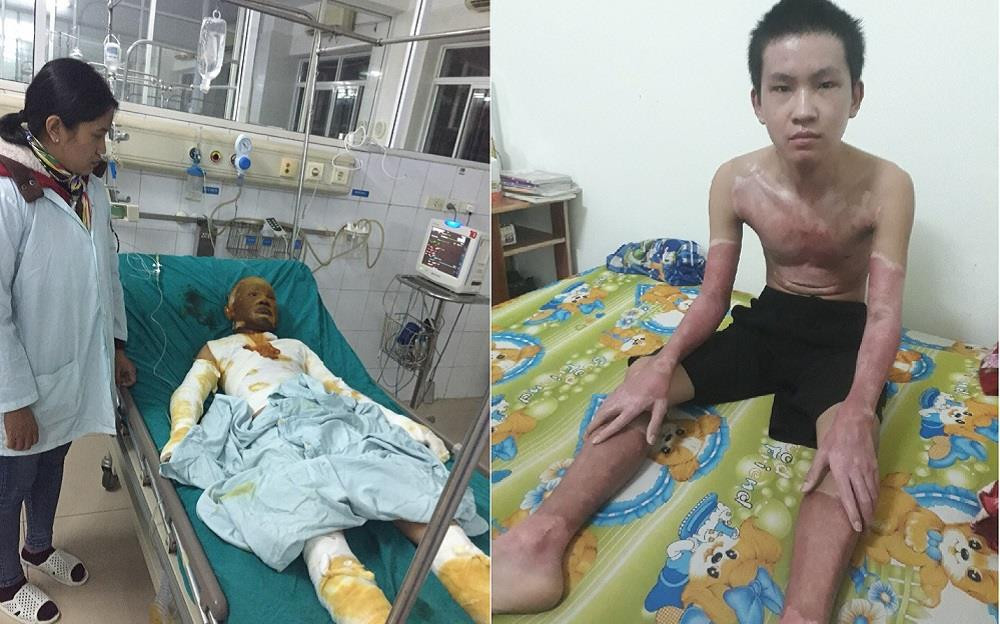 Phan Anh Tuấn "hồi sinh" sau điều trị với sự đồng hành của tấm thẻ Bảo hiểm y tế.