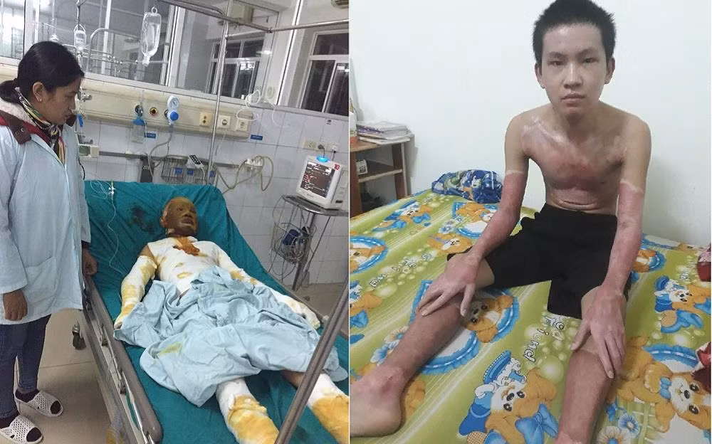 Phan Anh Tuấn "hồi sinh" sau điều trị với sự đồng hành của tấm thẻ Bảo hiểm y tế.