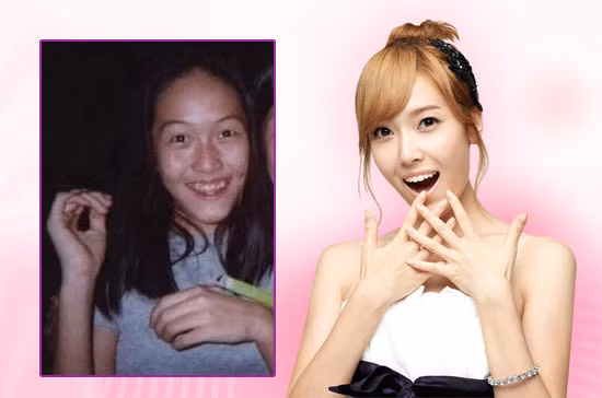 Jessica chắc phải cảm ơn nha sĩ đầu tiên, vì nhờ thế cô mới được cười thoải mái mà không phải ngại ngần. Xem thêm:Môi xinh nồng nàn, quyến rũ như Sao Hàn trên tạp chí Jessica chắc phải cảm ơn nha sĩ đầu tiên, vì nhờ thế cô mới được cười thoải mái mà không phải ngại ngần. Xem thêm:Môi xinh nồng nàn, quyến rũ như Sao Hàn trên tạp chí