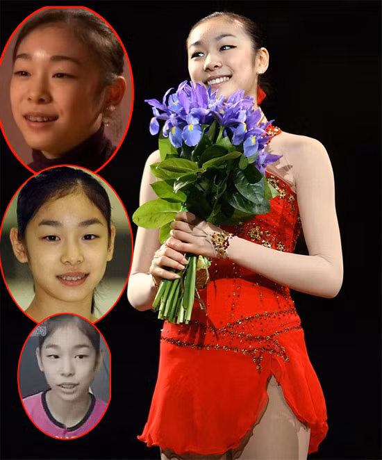 Kim Yuna đã phải đeo niềng răng để có được hàm răng đều tăm tắp và "sáng trưng" như vậy. Xem thêm:Môi xinh nồng nàn, quyến rũ như Sao Hàn trên tạp chí Kim Yuna đã phải đeo niềng răng để có được hàm răng đều tăm tắp và "sáng trưng" như vậy. Xem thêm:Môi xinh nồng nàn, quyến rũ như Sao Hàn trên tạp chí