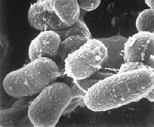 Bệnh Crohn: Người mắc bệnh Crohn, một bệnh viêm ruột do tự miễn nên chọn những loại thực phẩm dịu nhẹ với dạ dày và ruột để giúp đường tiêu hóa lành lại và nên hạn chế ăn trái cây, rau quả và ngũ cốc nguyên hạt trong suốt quá trình phát bệnh. Xem thêm:7 loại thực phẩm giúp bạn trẻ lâu hơn Bệnh Crohn: Người mắc bệnh Crohn, một bệnh viêm ruột do tự miễn nên chọn những loại thực phẩm dịu nhẹ với dạ dày và ruột để giúp đường tiêu hóa lành lại và nên hạn chế ăn trái cây, rau quả và ngũ cốc nguyên hạt trong suốt quá trình phát bệnh. Xem thêm:7 loại thực phẩm giúp bạn trẻ lâu hơn