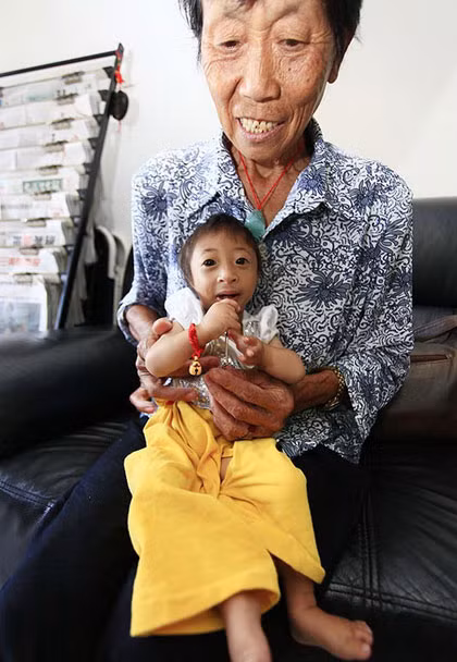 Khi chào đời, Liang nặng vỏn vẹn 1,05kg và cao 33cm. Đã ba năm trôi qua, cô bé chỉ tăng thêm 21cm chiều cao và nặng 2,5kg. Đây quả là con số gây sốc. Khi chào đời, Liang nặng vỏn vẹn 1,05kg và cao 33cm. Đã ba năm trôi qua, cô bé chỉ tăng thêm 21cm chiều cao và nặng 2,5kg. Đây quả là con số gây sốc.