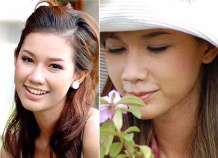 Cùng lúc đó, người ta nhắc tới Quỳnh Chi nhiều hơn, "soi" cô kỹ hơn và bắt đầu nghi ngờ vẻ đẹp của cô không hoàn toàn tự nhiên mà có nhờ đến sự can thiệp của dao kéo: nâng mũi, độn cằm...So sánh những bức hình trước và sau khi thi Miss Teen 2009 người ta dễ dàng nhận ra nhiều điểm khác biệt, sống mũi cao hơn, cánh mũi gọn hơn và gương mặt cũng thon thả hơn.