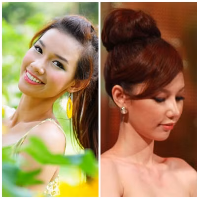 Hình ảnh đối chiếu chiếc mũi trước và sau phẫu thuật của Quỳnh Chi