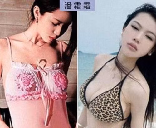 Bồ cũ của Lâm Phong, Phan Sương Sương nổi tiếng với đôi gò bồng đào căng tròn nhưng cô cũng từng phải đi thẩm mỹ để thay đổi kích cỡ đáng kể vòng ngực.