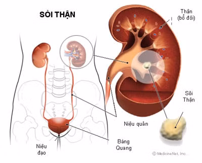 Bệnh thận: Tránh canxi, dù bị bất kỳ loại bệnh gì liên quan đến thận, bạn cần loại canxi khỏi danh sách bổ sung. Uống canxi trên 700 mg mỗi ngày có thể dẫn tới lắng đọng khoáng chất này trong thận, lâu ngày trở thành sỏi thận.