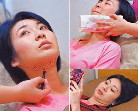 Trang Tư Mẫn đi loại bỏ mỡ cằm vào cuối năm ngoái.