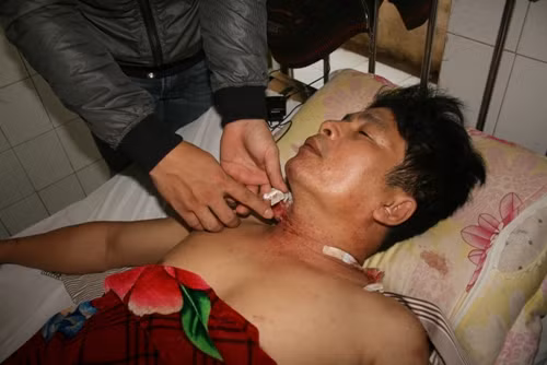 Cho thôi việc trưởng công an xã say rượu bắn người ảnh 1
