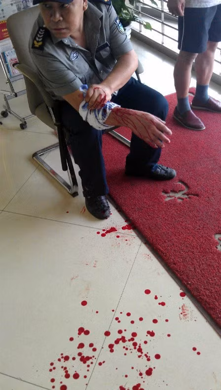 Bảo vệ ngân hàng bị bắn vào tay