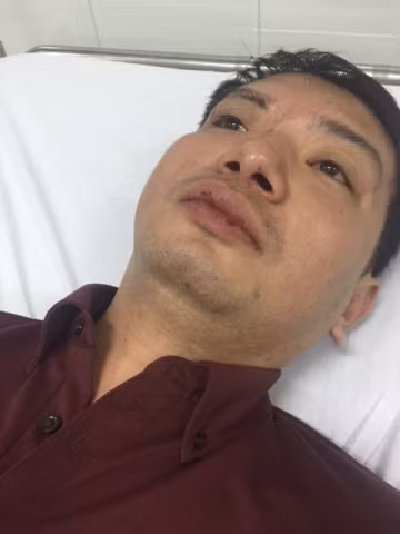 Anh Nguyễn Như Toàn với những vết thương bầm dập trên môi của mình. Anh Nguyễn Như Toàn với những vết thương bầm dập trên môi của mình.